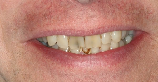 Cosmetic Dentistry Services Wisconsin