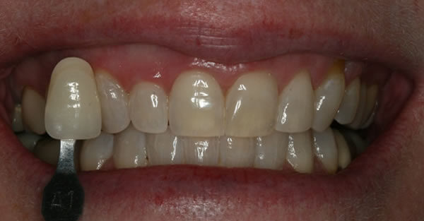 Cosmetic Dentistry Services Wisconsin