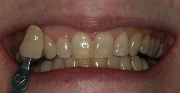 Cosmetic Dentistry Services Wisconsin