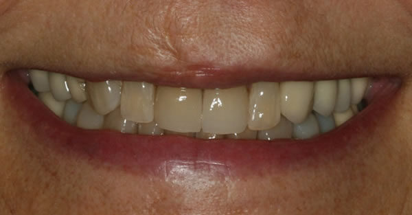 Restorative Dentistry Services Wisconsin