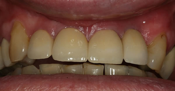 Restorative Dentistry Services Wisconsin