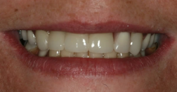 Restorative Dentistry Services Wisconsin