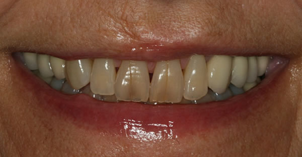Restorative Dentistry Services Wisconsin
