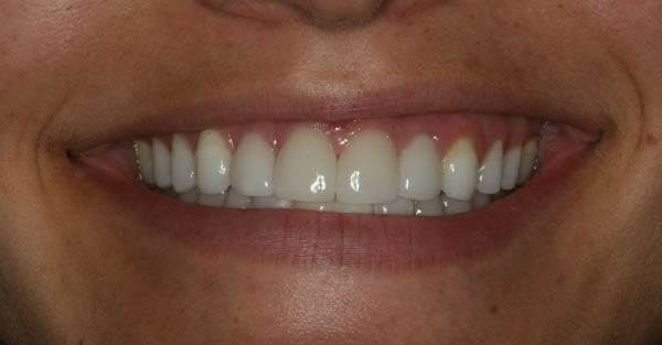 Restorative Dentistry Services Wisconsin