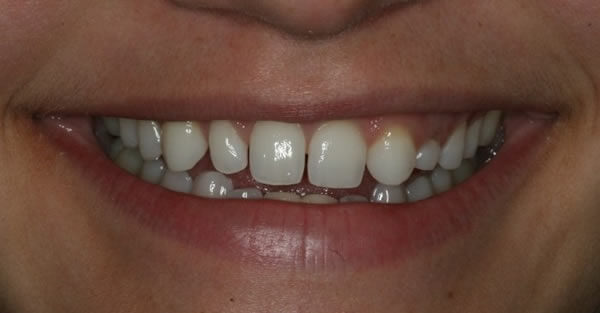 Restorative Dentistry Services Wisconsin