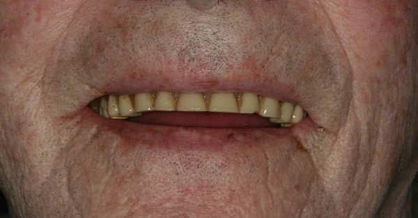Restorative Dentistry Services Wisconsin