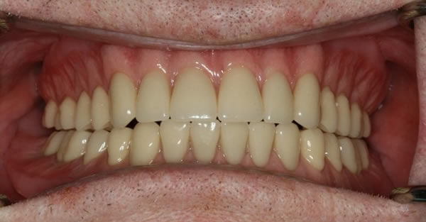 Restorative Dentistry Services Wisconsin