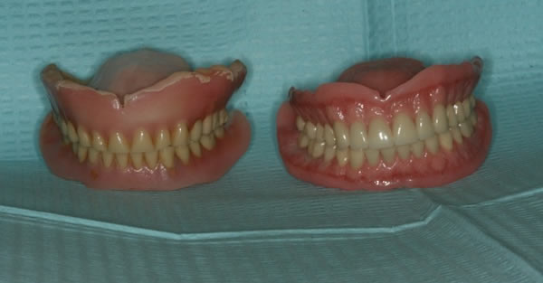 Restorative Dentistry Services Wisconsin