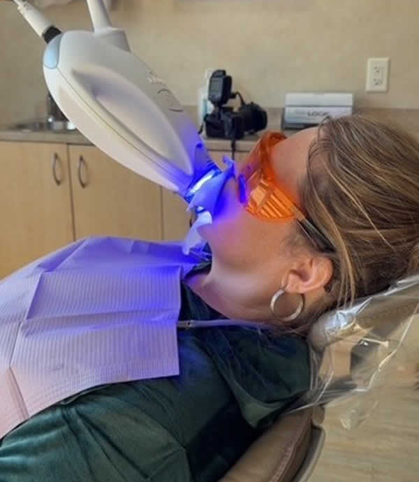 Teeth Whitening Dentists Sun Prairie WI