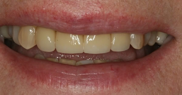 Cosmetic Dentistry Services Wisconsin