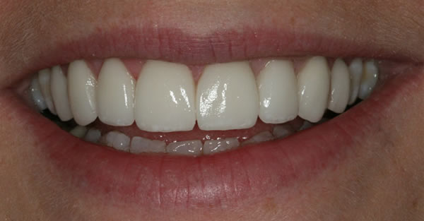 Cosmetic Dentistry Services Wisconsin