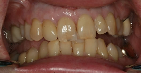 Cosmetic Dentistry Services Wisconsin